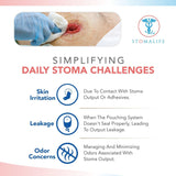 "Stomalife Skin Barrier Rings - 10 Rings | Easy-Clean, Leak-Proof | Adhesive Seals for Ostomy-Colostomy-Ileostomy"